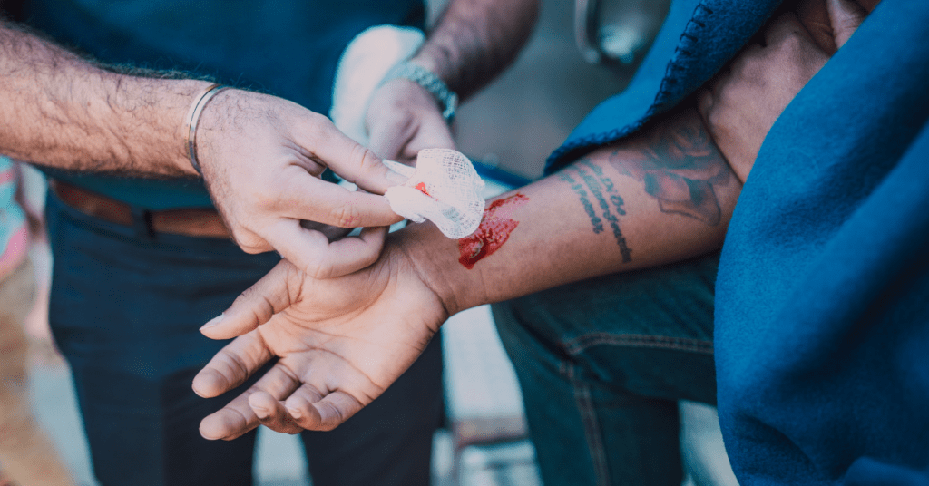 TAKING CARE OF DOG BITES 3 6